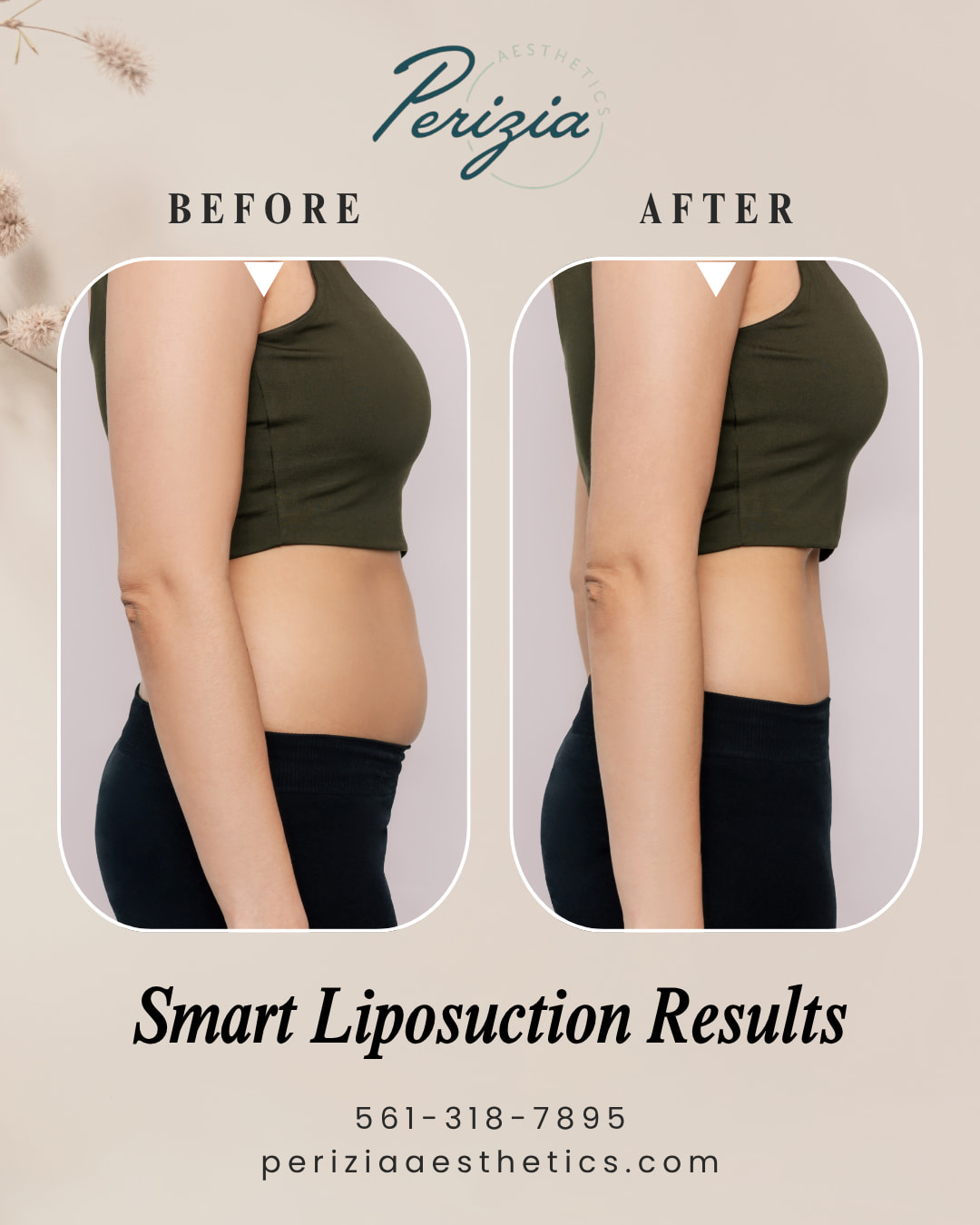 Discover the next level of body confidence with Smart Liposuction — a modern, minimally invasive approach designed for smooth, natural-looking contours.
Most clients begin to see visible improvements within just 4 to 6 weeks, with continued tightening and refining over the following months. Experience why so many people describe it as one of the most rewarding aesthetic treatments available today. Watch the transformation at Perizia Aesthetics in Jupiter, Florida.
#PeriziaAesthetics #SmartLiposuction #JupiterFL #BodyContour #LaserLipo #ConfidenceRedefined #AestheticInnovation #GlowWithPerizia