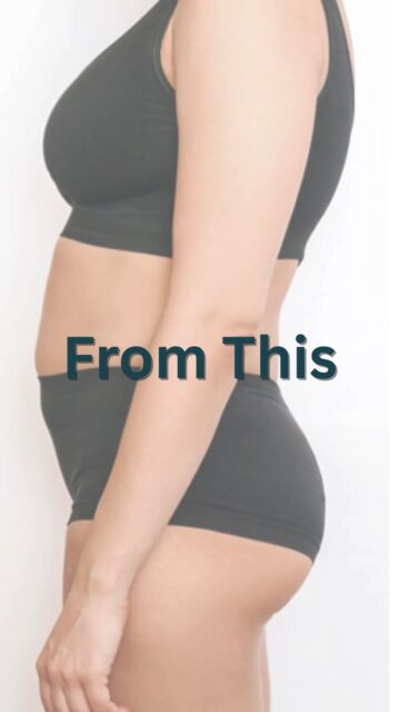 Thinking about reshaping your confidence? Perizia Aesthetics is offering $1000 OFF liposuction for a limited time. If you’ve been searching for liposuction in Jupiter, this is your moment.
Experience advanced body contouring, personalized care, and results designed to enhance your natural shape.
Book your consultation today and start your transformation.
#PeriziaAesthetics #LiposuctionInJupiter #BodyContouring #AestheticMedicine #SpecialOffer #ConfidenceBoost #JupiterFL #limitedtimeoffer #liposuctionjupiter #liposuctionjupiterflorida