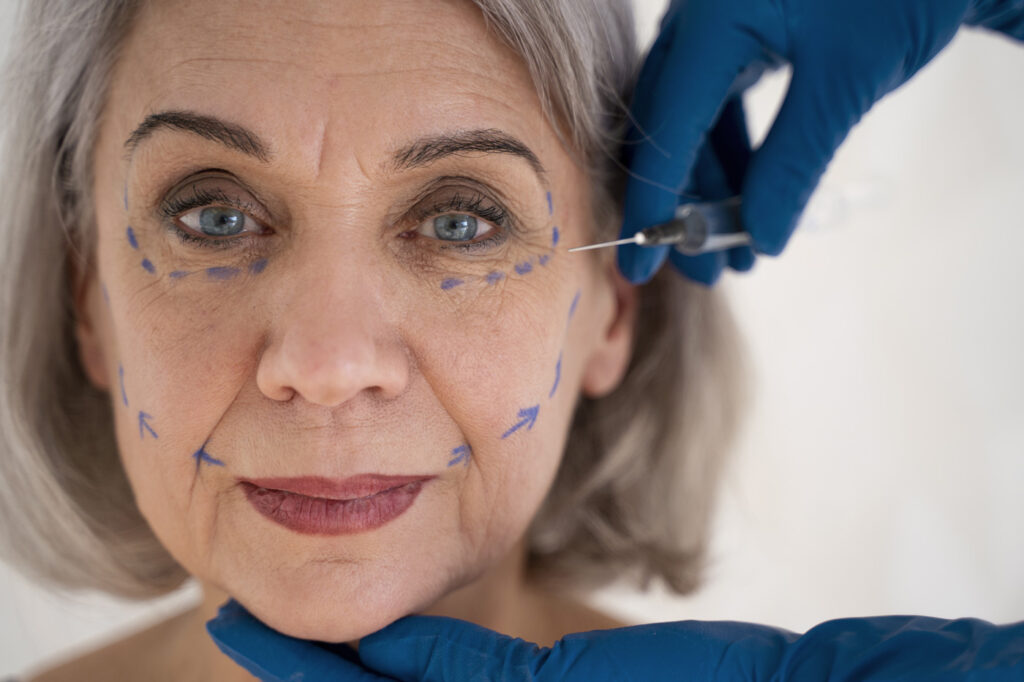 Dermal Filler for Wrinkles & Fine Lines