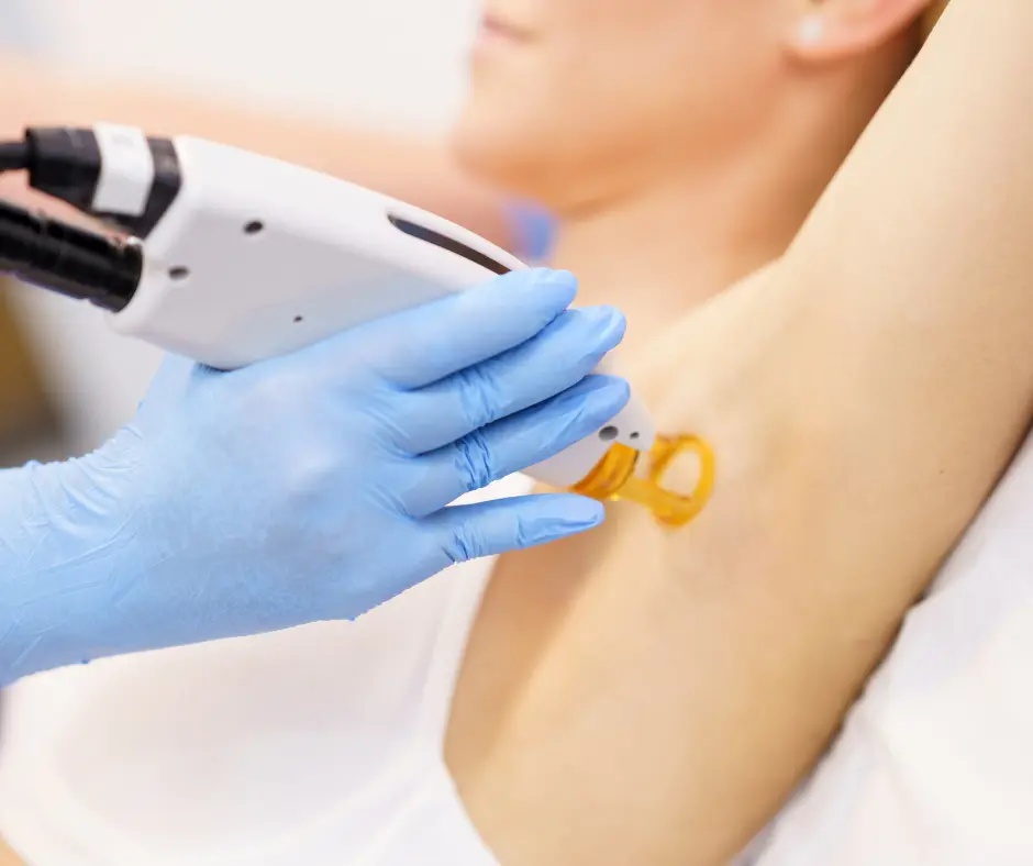 Laser Hair Removal for the Underarms