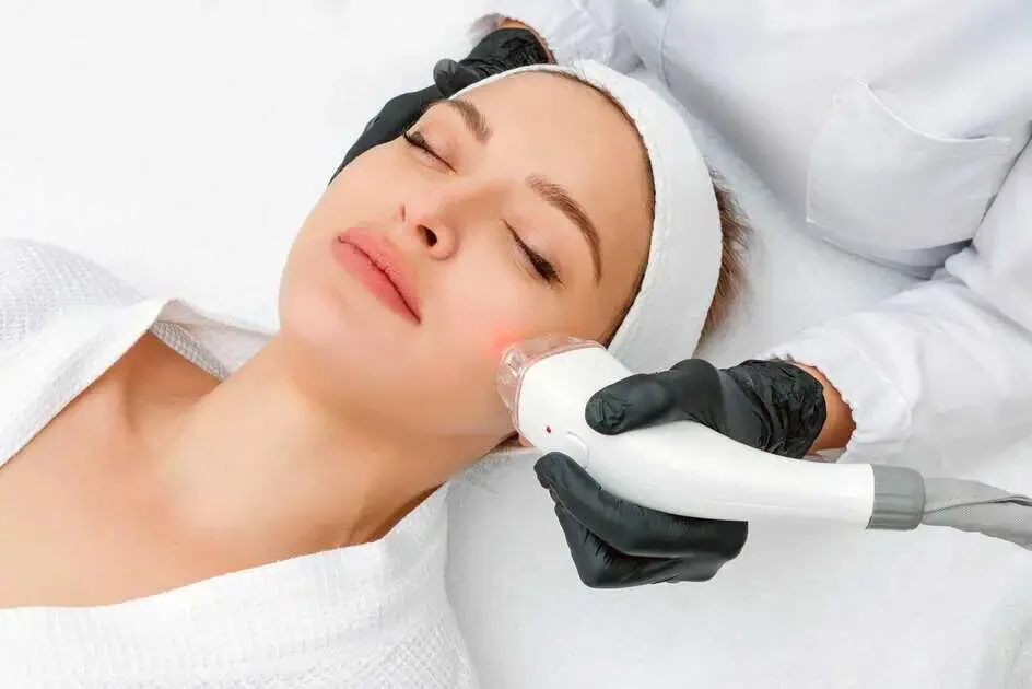 Microneedling Treatment Experience