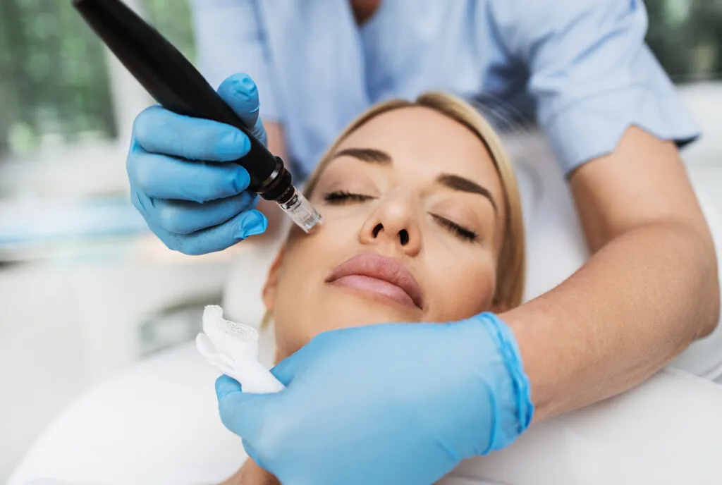 What Is RF Microneedling