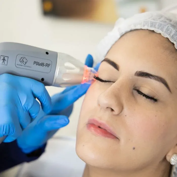 Powerful Benefits of PiXel8-RF Microneedling