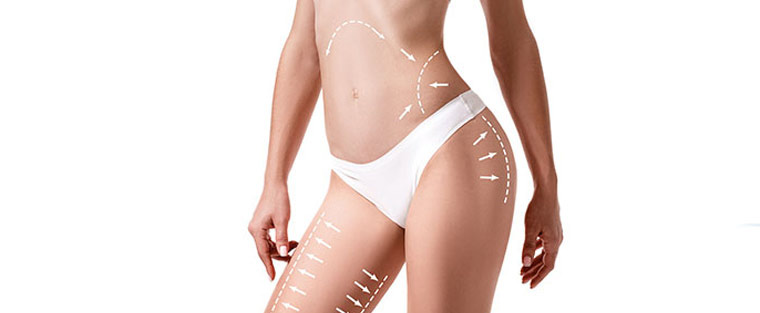 Common Smart Lipo Target Zones