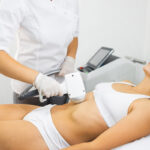 Abdomen Laser Hair Removal in Jupiter