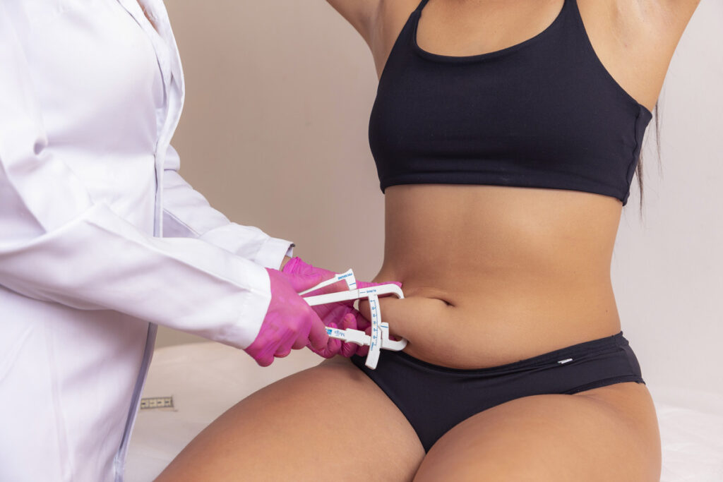 Combining Liposuction and Tummy Tuck