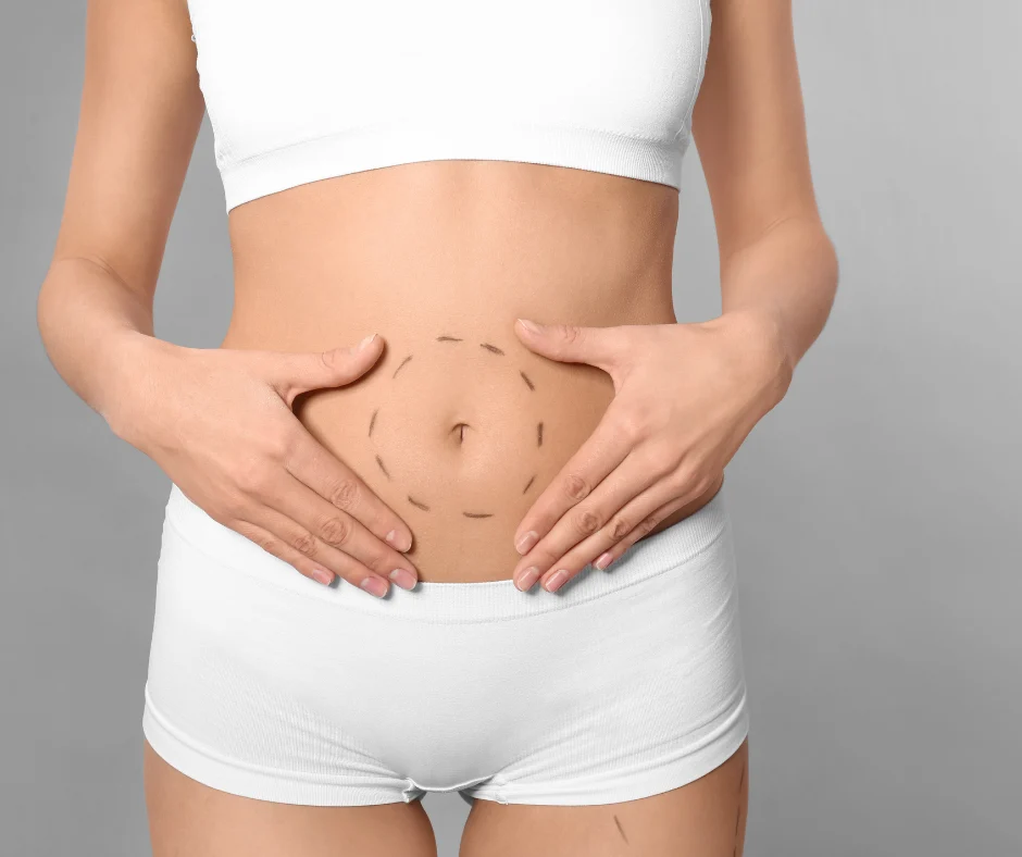 Fat Grafting vs. Fillers