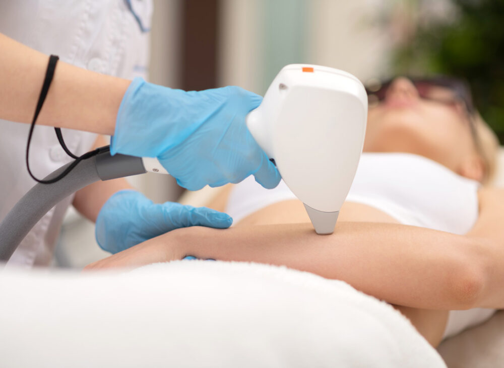 Laser Hair Removal for Arms in Jupiter