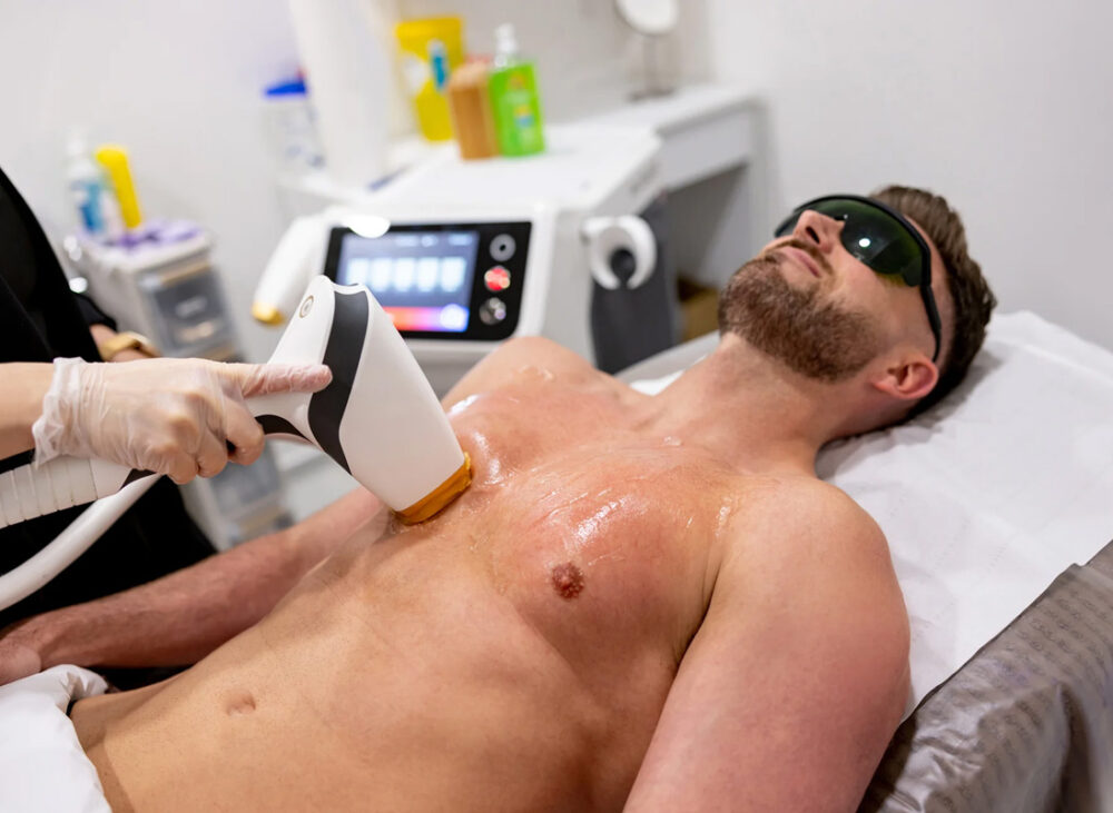 Laser Hair Removal for Men in Jupiter