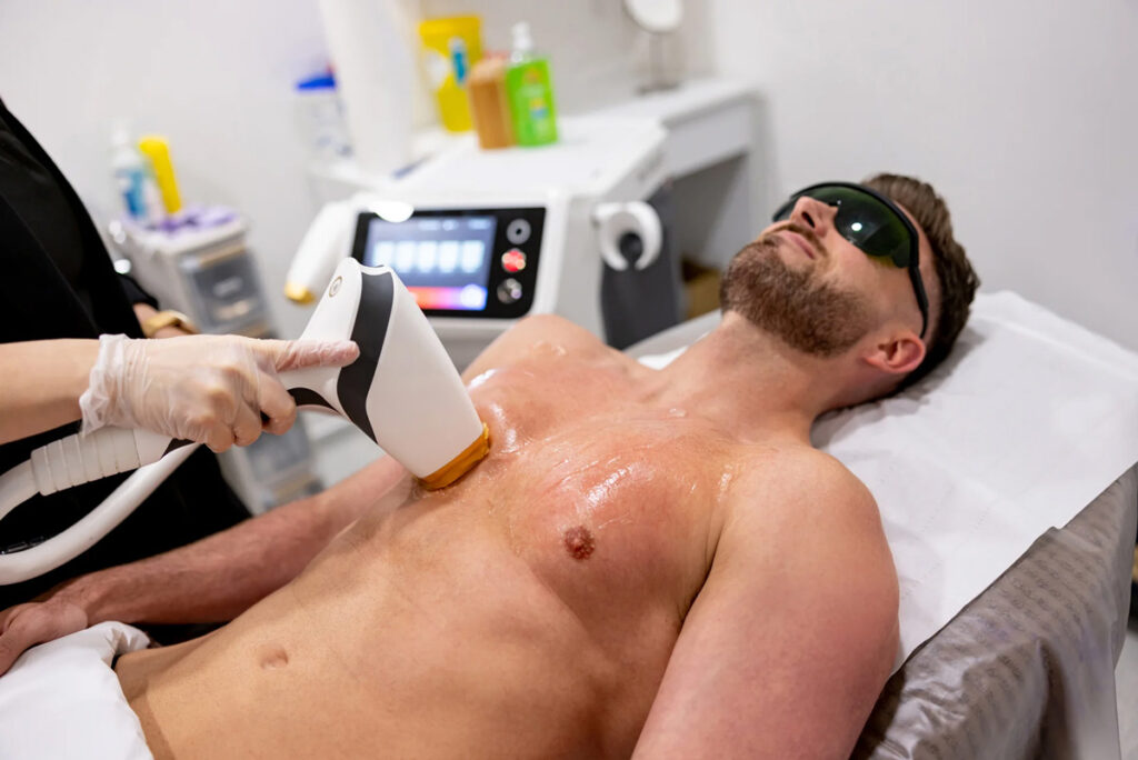Laser Hair Removal for Men in Jupiter