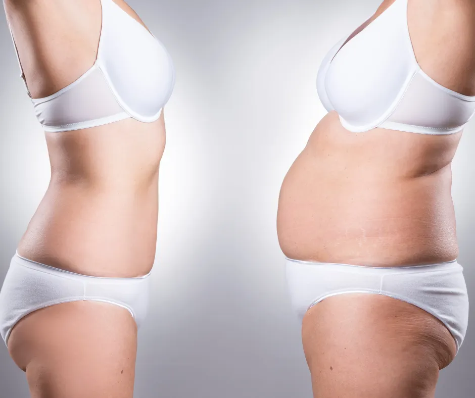 Medical Weight Loss Jupiter Fl
