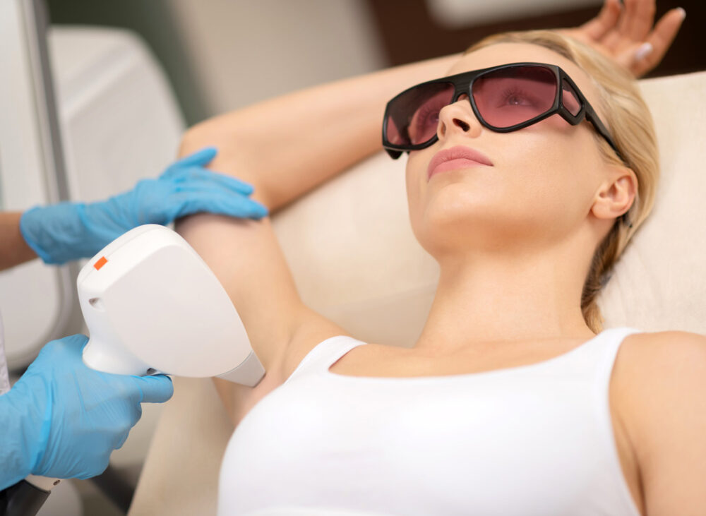Underarm Laser Hair Removal in Jupiter, FL