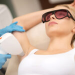 Underarm Laser Hair Removal in Jupiter, FL