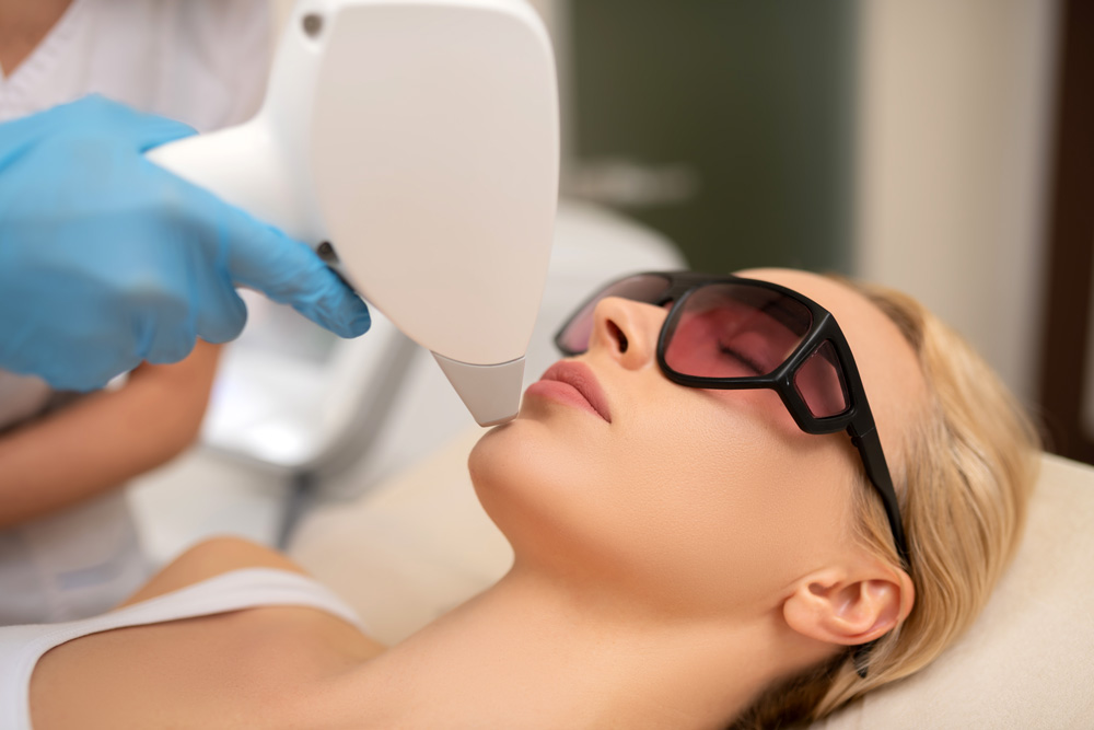 What Is Facial Laser Hair Removal