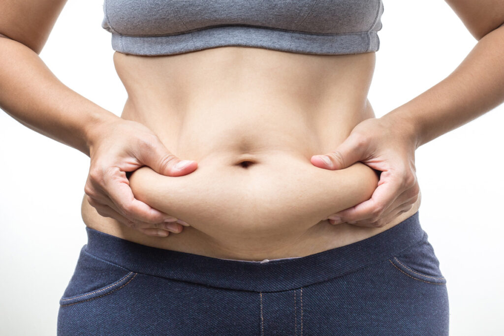 What is a Tummy Tuck