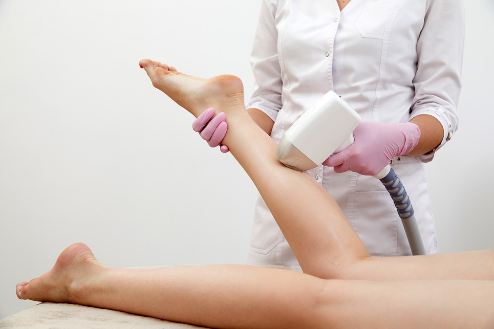Who is an Ideal Candidate for Leg Laser Hair Removal