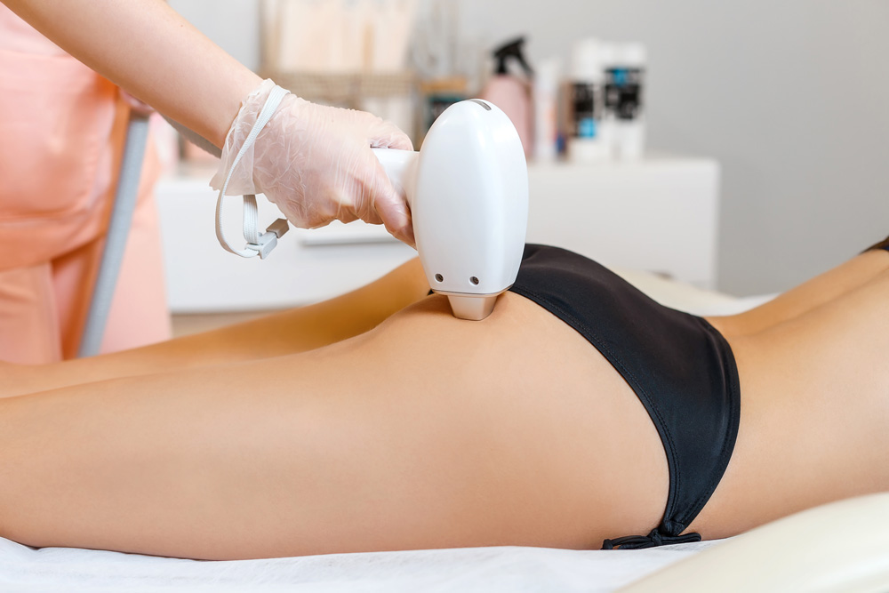 Why Consider Laser Hair Removal for the Buttocks