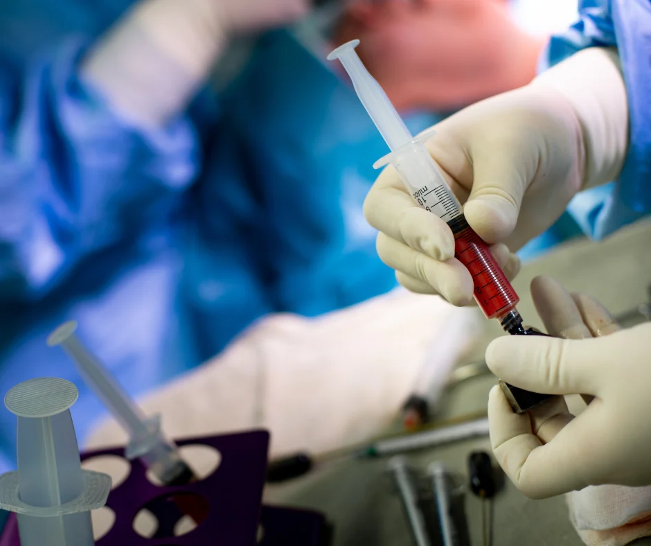 Fat Grafting Benefits in Jupiter, Fl