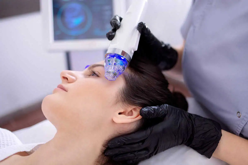 Benefits of RF Microneedling for Skin Rejuvenation