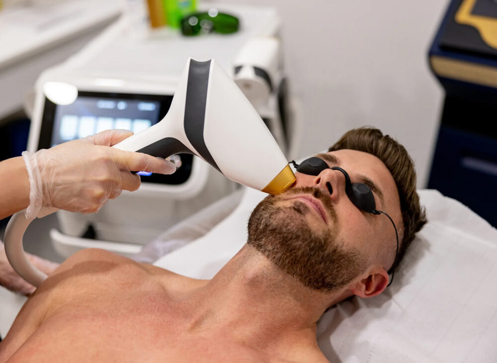 Can You Shave After Laser Hair Removal