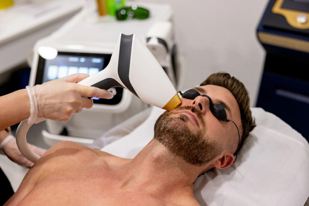 Can You Shave After Laser Hair Removal