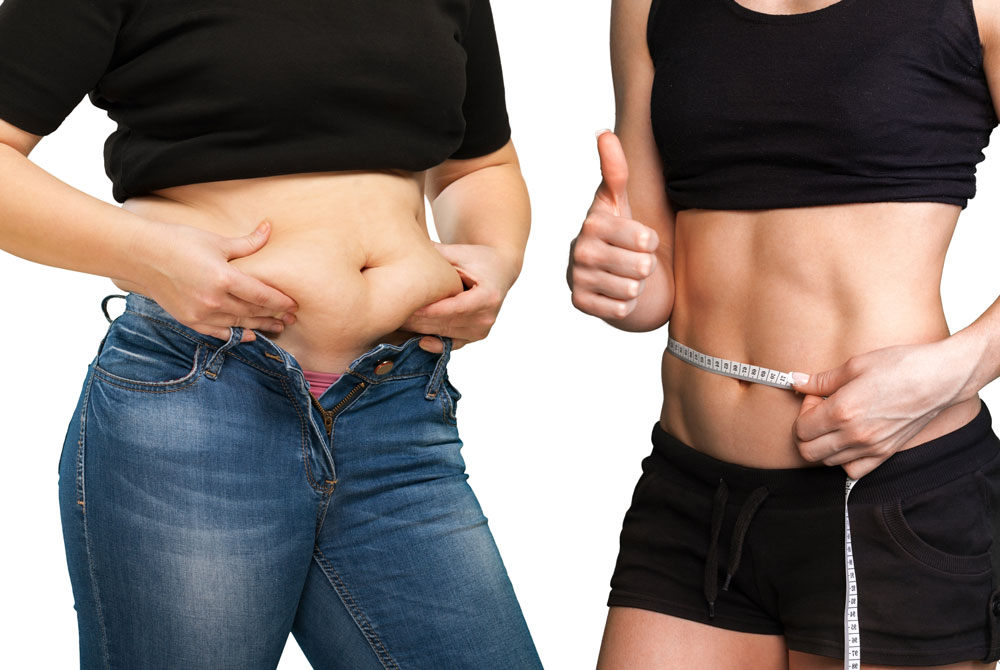 How-Much-Fat-and-Weight Can Liposuction Actually Remove