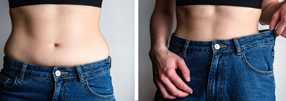 How to Maintain and Maximize Your Liposuction Results