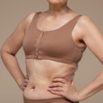 Liposuction for Belly Fat in Older Adults