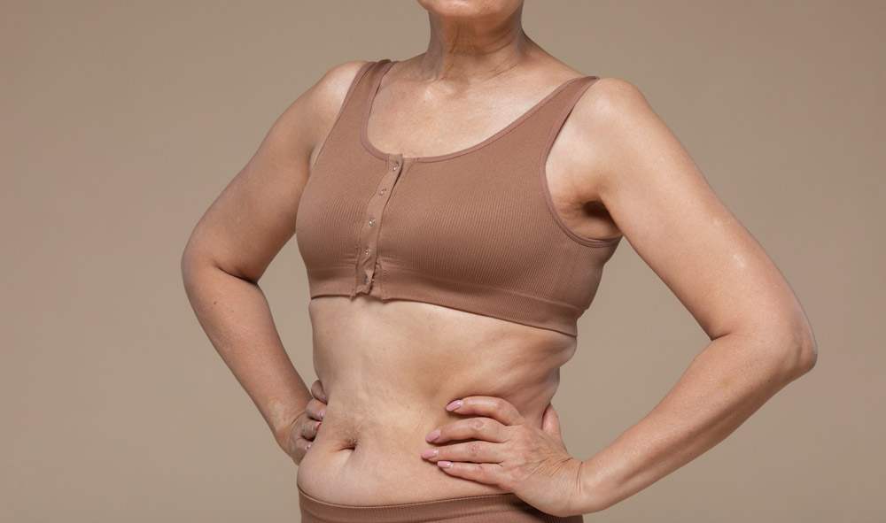 Liposuction for Belly Fat in Older Adults