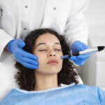RF Microneedling for Skin Tightening in Jupiter, FL