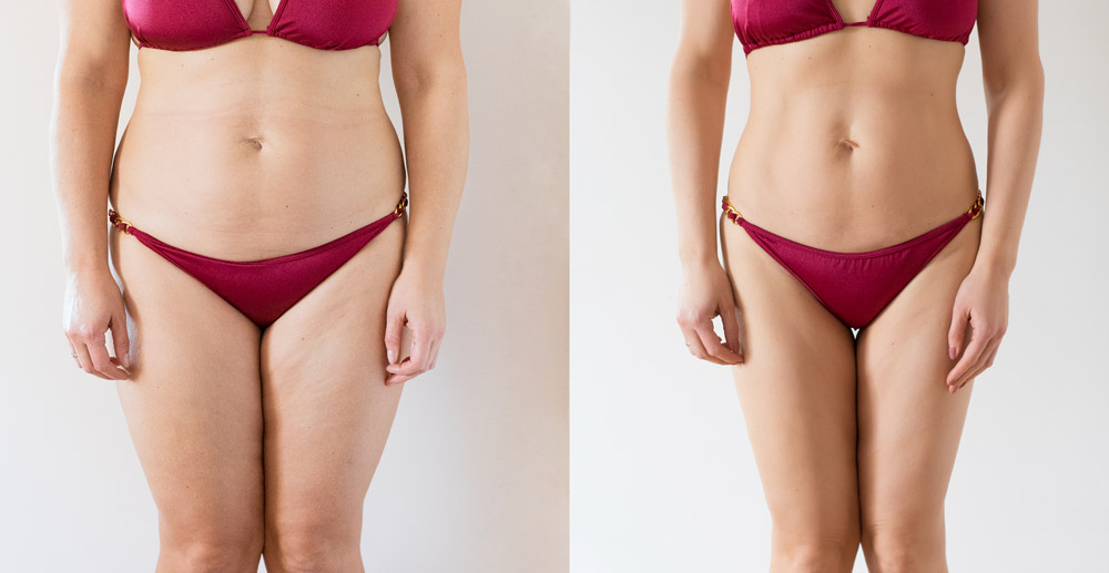 Recovery Timeline and Aftercare at Perizia Aesthetics