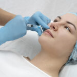 Surprising Areas You Can Treat with Dermal Fillers