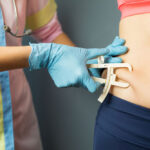 What Are the Long-Term Effects of Liposuction?