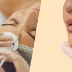 Botox vs. Dermal Fillers